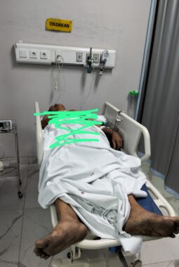 Terpergok Curi Motor AM Babak Belur Dihajar Warga 