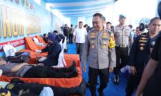Operasi Katarak hingga Bibir Sumbing Gratis, Ribuan Warga Serbu Bakti Kesehatan Polda Sumsel