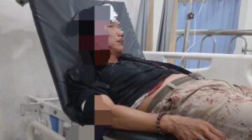 Karyawan Swasta di Palembang Ditusuk Berkali-kali, Keluarga Lapor ke Polisi