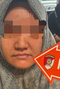 Tak Angkat Telepon Suami, Dokter Muda di Palembang Mengaku Dianiaya Mertua